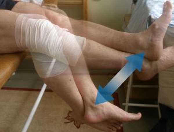 Сколько восстанавливается нога после перелома